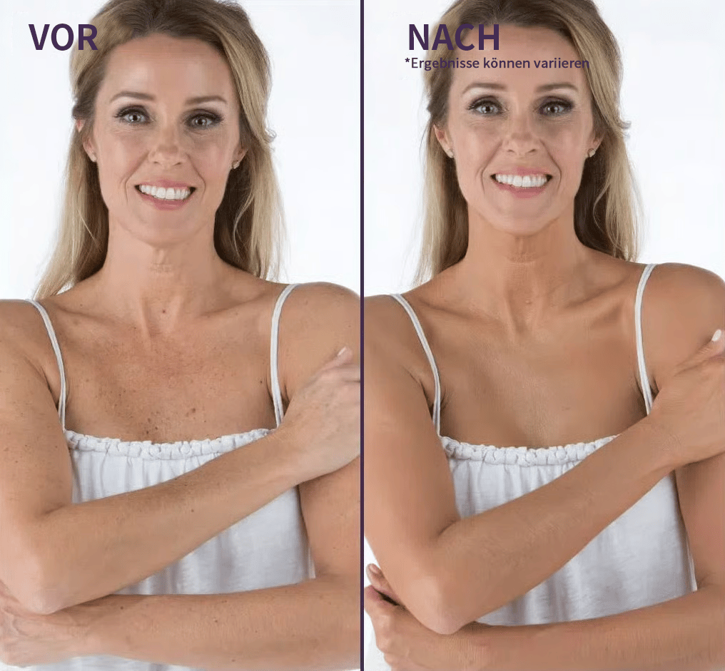 🎁LETZTER TAG SALE 49% RABATT🔥Weicher, matter Creme-Concealer