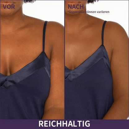 🎁LETZTER TAG SALE 49% RABATT🔥Weicher, matter Creme-Concealer