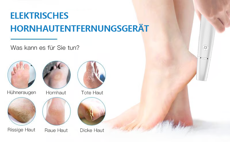 🏆Letzter Tag: Nur €12.99!!💥⚡50K+ verkauft!🔥Elektrischer Hornhautentferner🎁1*Ersatzkopf inklusive🎁