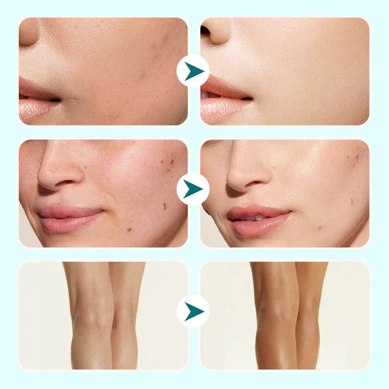 🎁Letzter Tag - Kaufe 1 bekomme 1 gratis🎉Alles-in-Einem Feuchtigkeitscreme, Concealer & Abdeckung✨Leicht und wasserfest💧