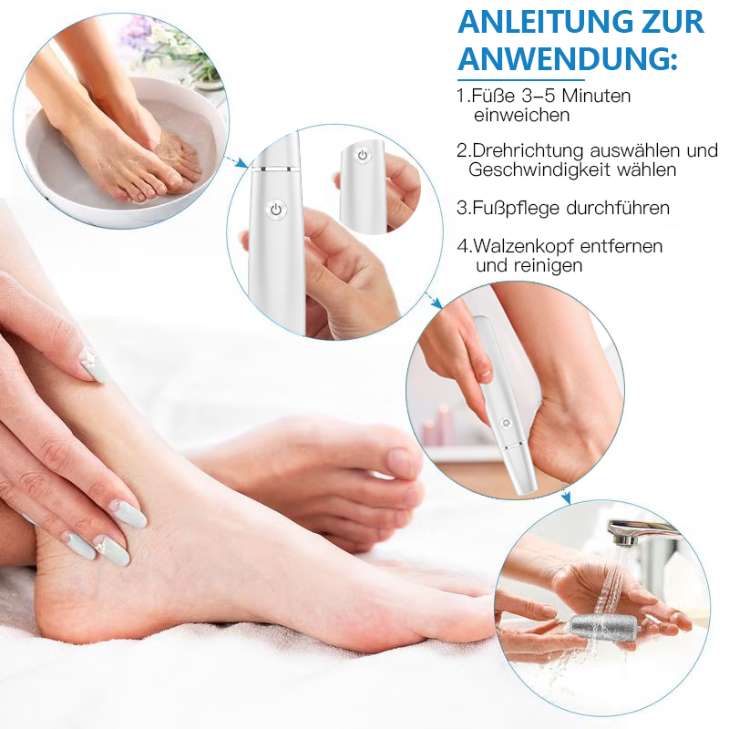 🏆Letzter Tag: Nur €12.99!!💥⚡50K+ verkauft!🔥Elektrischer Hornhautentferner🎁1*Ersatzkopf inklusive🎁