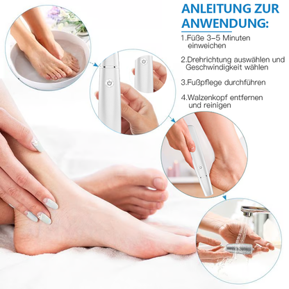 🏆Letzter Tag: Nur €12.99!!💥⚡50K+ verkauft!🔥Elektrischer Hornhautentferner🎁1*Ersatzkopf inklusive🎁