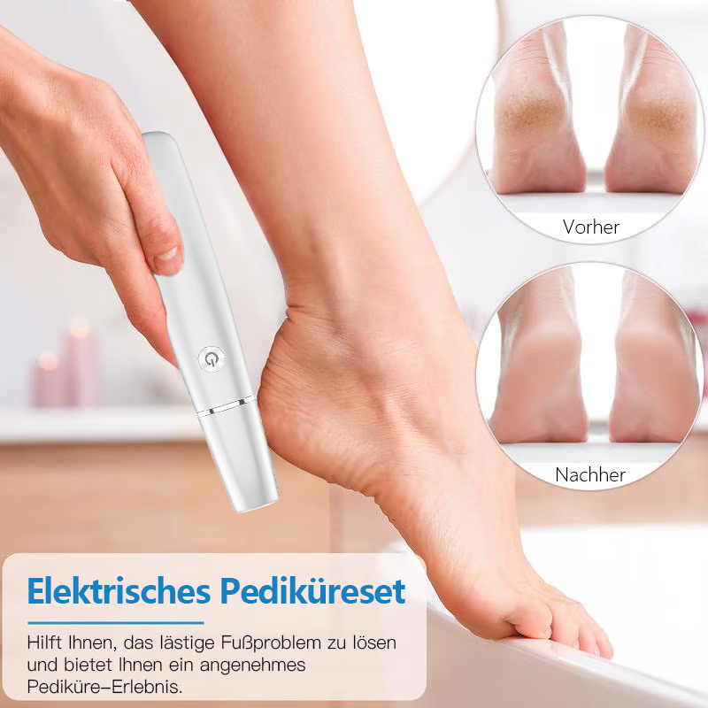 🏆Letzter Tag: Nur €12.99!!💥⚡50K+ verkauft!🔥Elektrischer Hornhautentferner🎁1*Ersatzkopf inklusive🎁