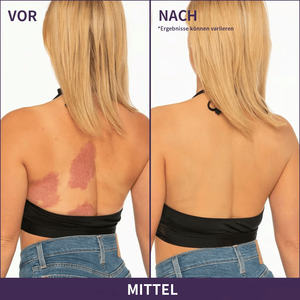 🎁LETZTER TAG SALE 49% RABATT🔥Weicher, matter Creme-Concealer