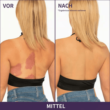 🎁LETZTER TAG SALE 49% RABATT🔥Weicher, matter Creme-Concealer