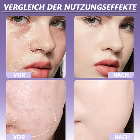 🎁LETZTER TAG SALE 49% RABATT🔥Weicher, matter Creme-Concealer