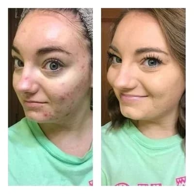 🔥Neujahrsangebot - Kaufen 1 bekommen 1 gratis & 1 Pinsel🎉3-in-1 Concealer Palette